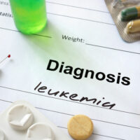 Acute Myeloid Leukemia &#8211; Stages, Types, Symptoms, Causes, and Therapies