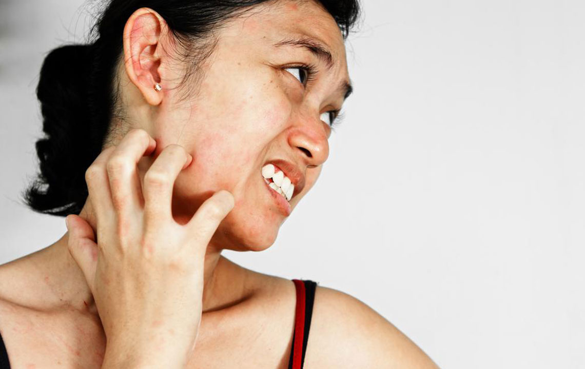 7 easy and useful ways to manage itchy skin