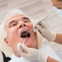 4 ways to get affordable senior dental implants