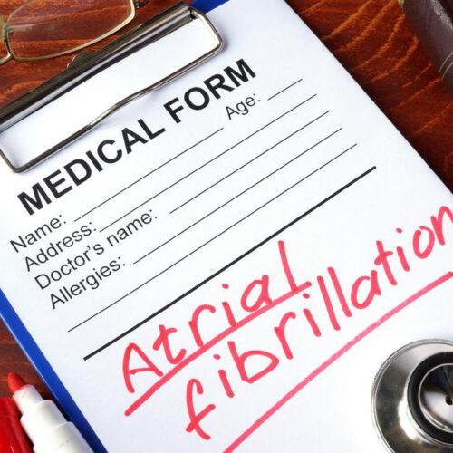 An overview of Atrial Fibrillation