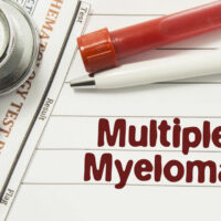 Dealing with multiple myeloma &#8211; Things you should know about