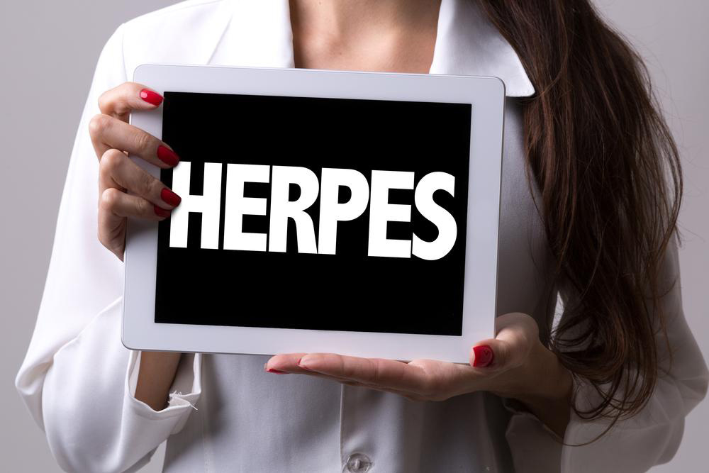 Effective alternative treatments to cure herpes