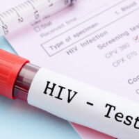 What are the early signs and symptoms of HIV infection?