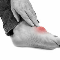 Top triggers for gout foot pain