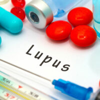 9 Early Signs and Symptoms of Lupus