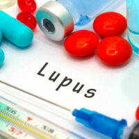 Common Treatment Options For Controlling Lupus