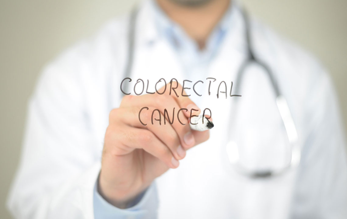 Causes and Diagnosis of Colorectal Cancer