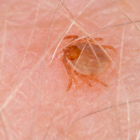 Effective Treatment Methods for Tick-borne Illness