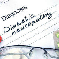 Everything You Need to Know about Diabetic Neuropathy