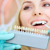 Everything You Need To Know About Dental Implants