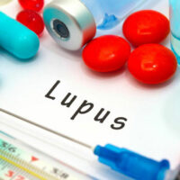 Here Are the 8 Early Signs of Lupus