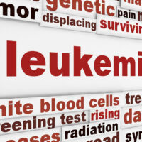 Symptoms, causes, and risk factors of leukemia