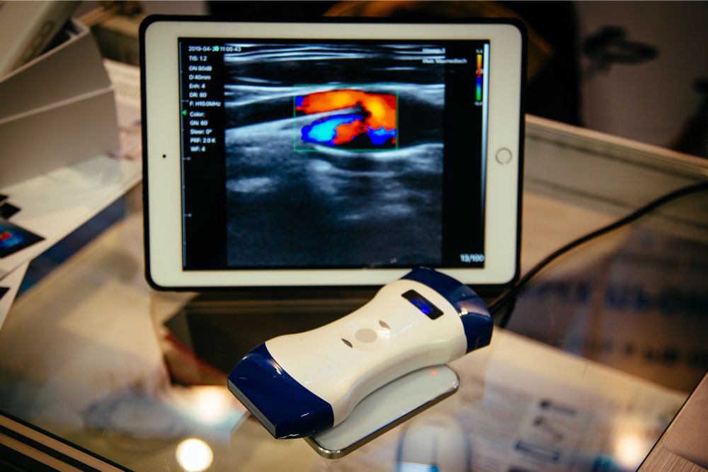 Portable ultrasound machines &#8211; Types and top choices