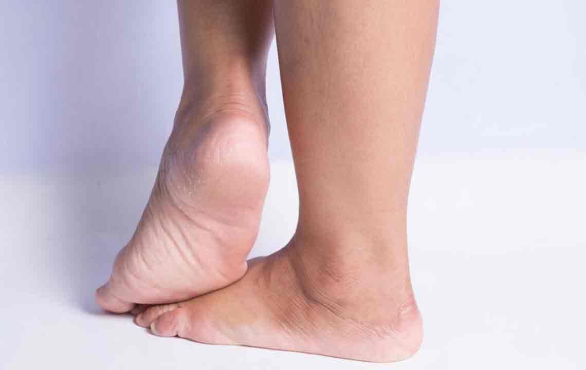 Walk In Stride By Treating Heel Pain