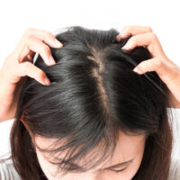 What To Know About Treating An Itchy Scalp