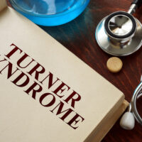 Turner Syndrome &#8211; Causes, Symptoms, and Management