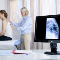 10 Tips for Choosing an Osteoporosis Specialist