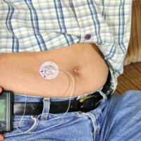 Insulin Pumps for Type 1 Diabetes &#8211; Types and Benefits