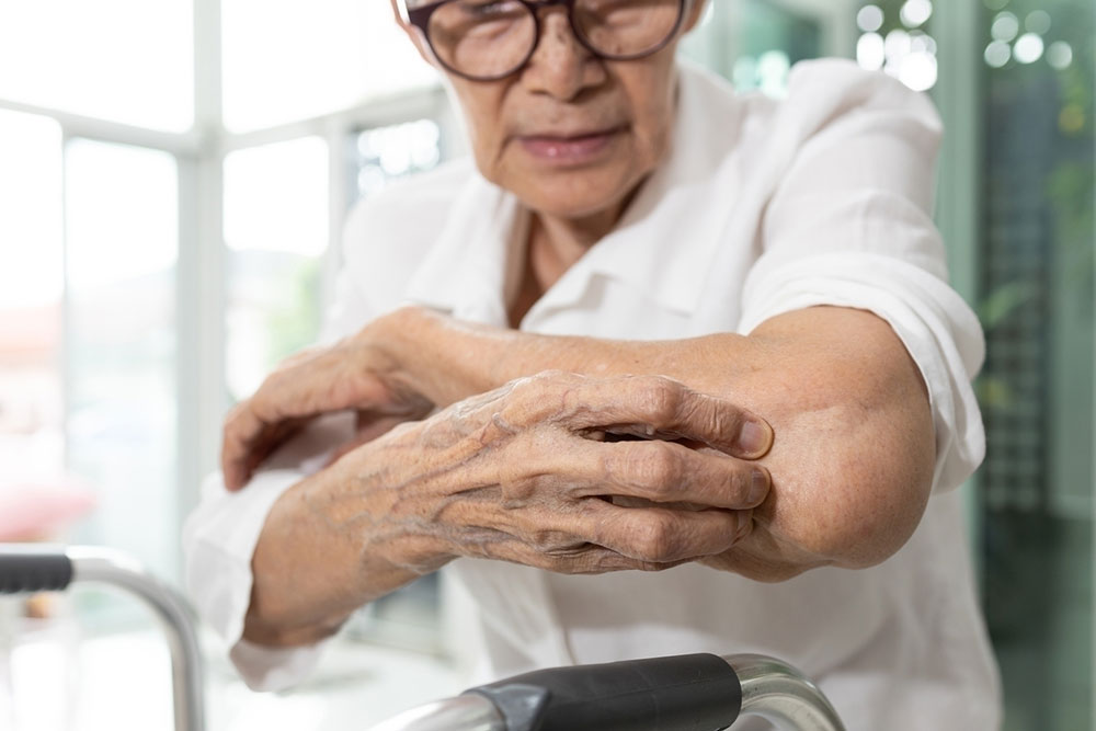 Itchy Skin in Seniors &#8211; Causes, Symptoms, and Management